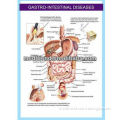 3D Medical Chart ---- Gastro-intestinal Disease